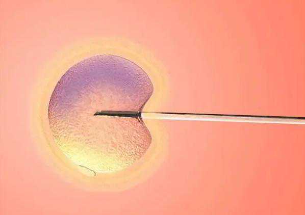 贵阳供卵官网,贵阳哪些女性不适合做试管婴儿-生男生女于精液流进入多少有关